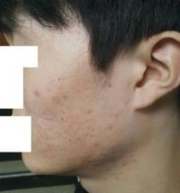 After