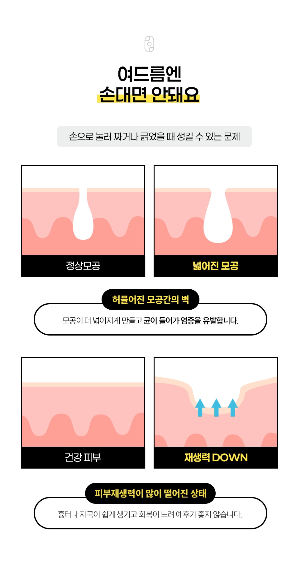 여드름을 손으로 짜면 안 되는 이유