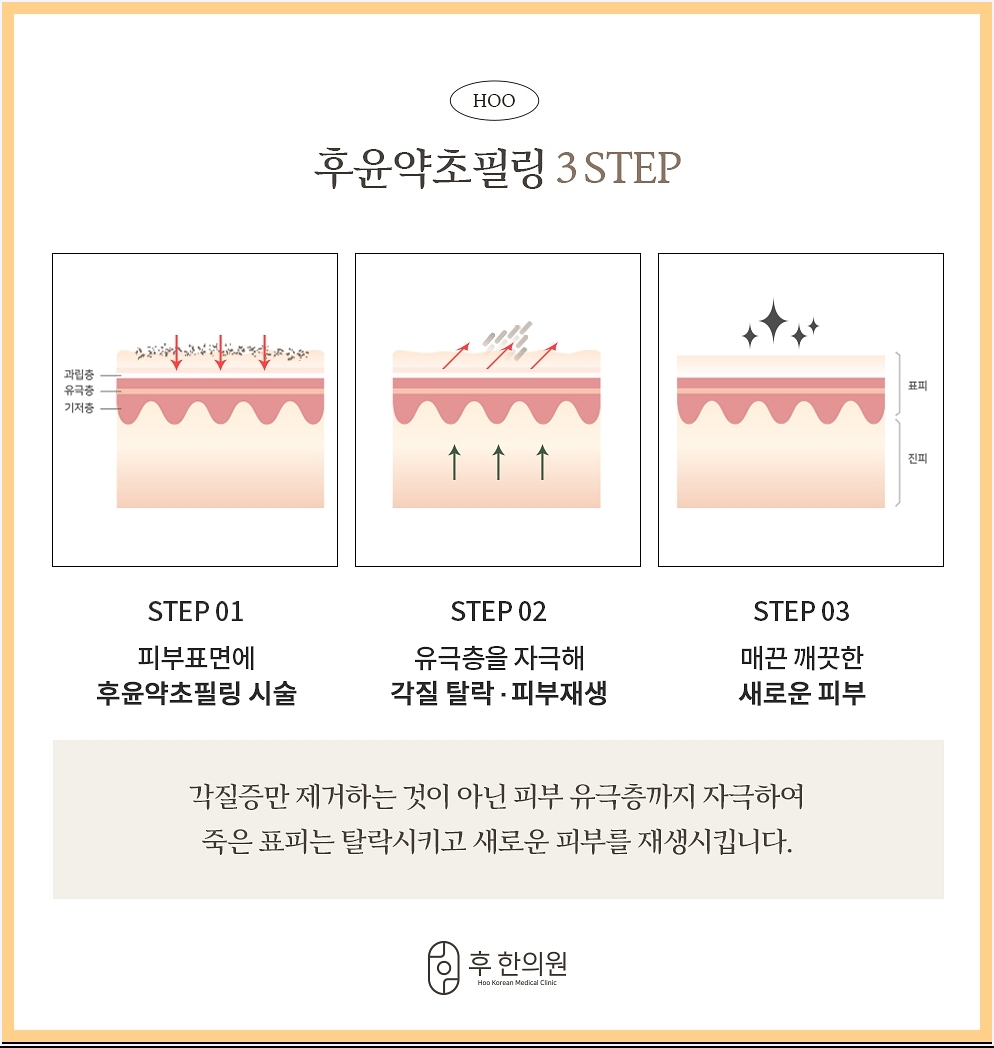 후윤약초필링 3단계 정리