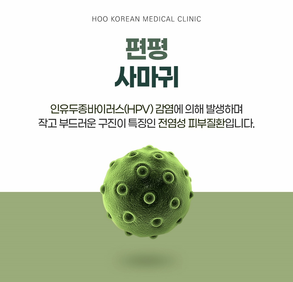 인유두종바이러스(HPV) 감염에 의한 편평사마귀 질환 정의 안내