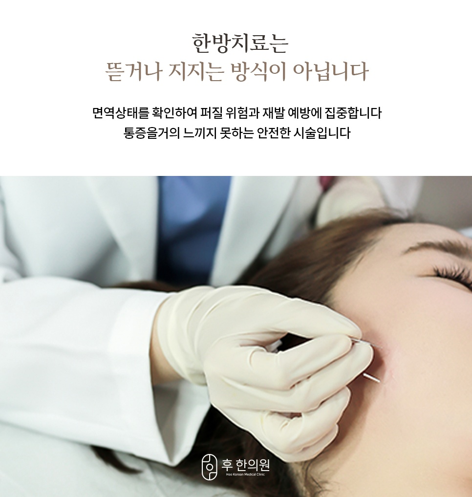 면역 상태 확인과 재발 예방에 초점을 둔 한방 침 치료 장면