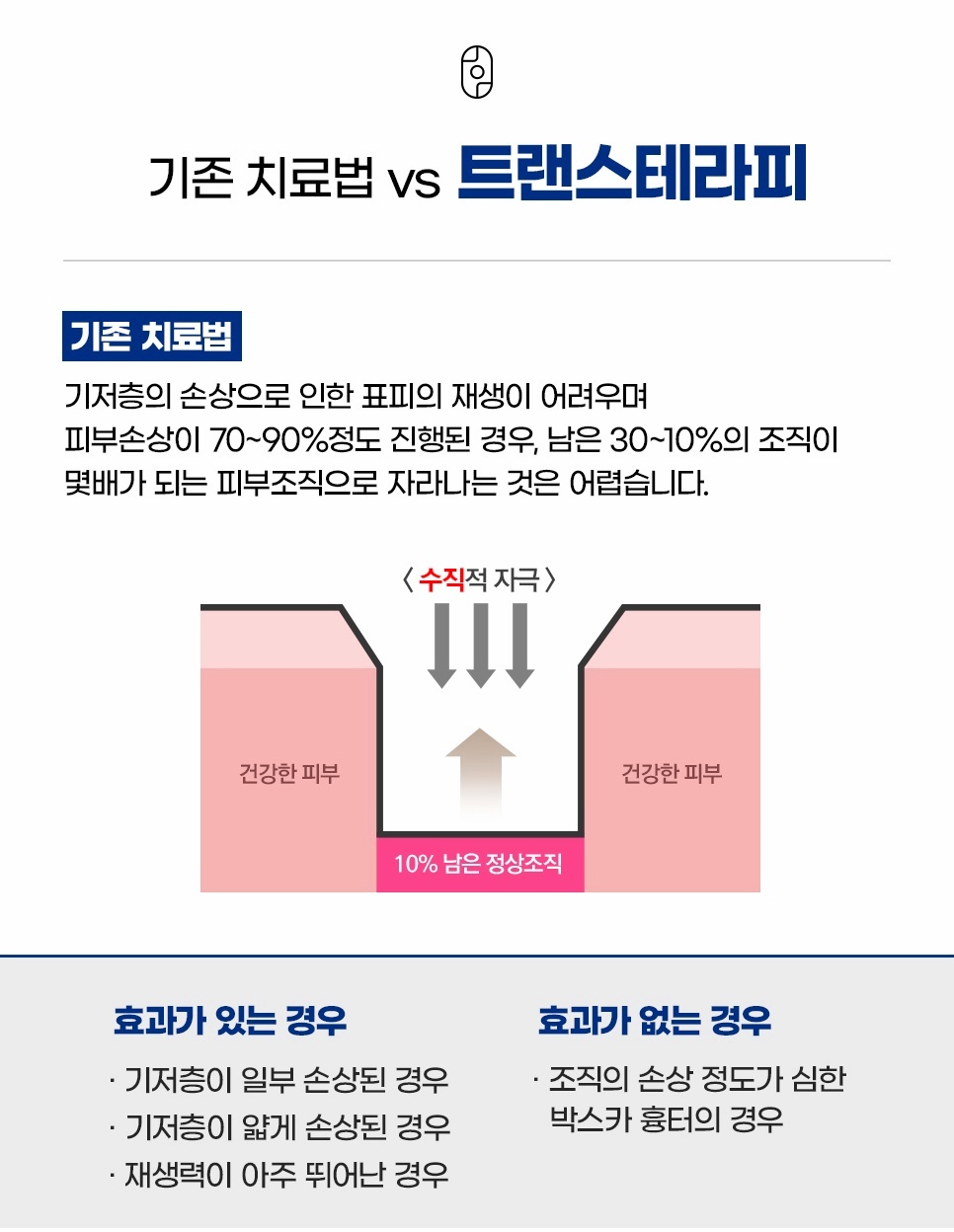 기존 흉터 치료법과 기저층 손상 원리 설명