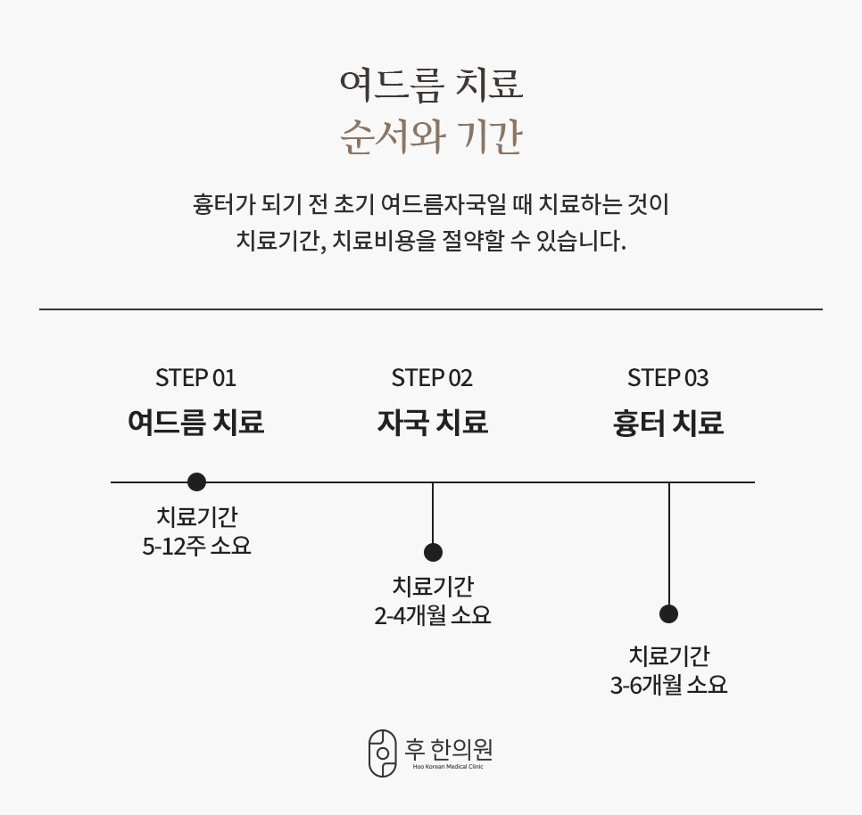 초기 여드름은 5~12주, 자국은 2~4개월, 흉터는 3~6개월로 이어지는 여드름 치료 순서와 기간