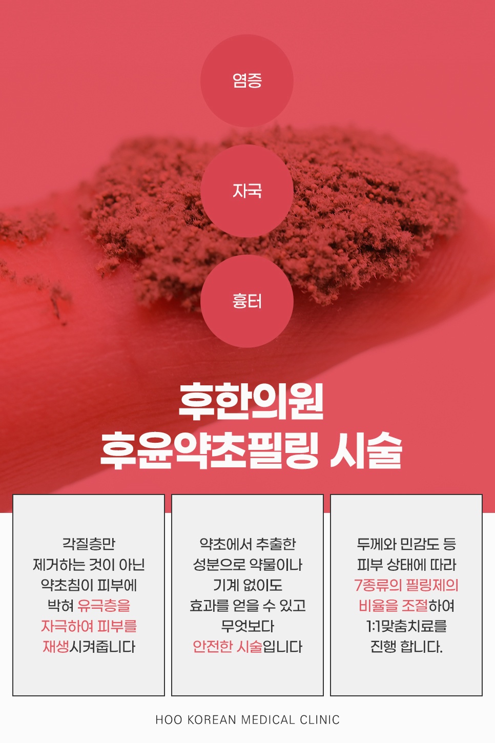 각질층만 제거하지 않고 유극층을 자극해 재생시키는 약초침 후윤약초필링 시술의 특징 3가지