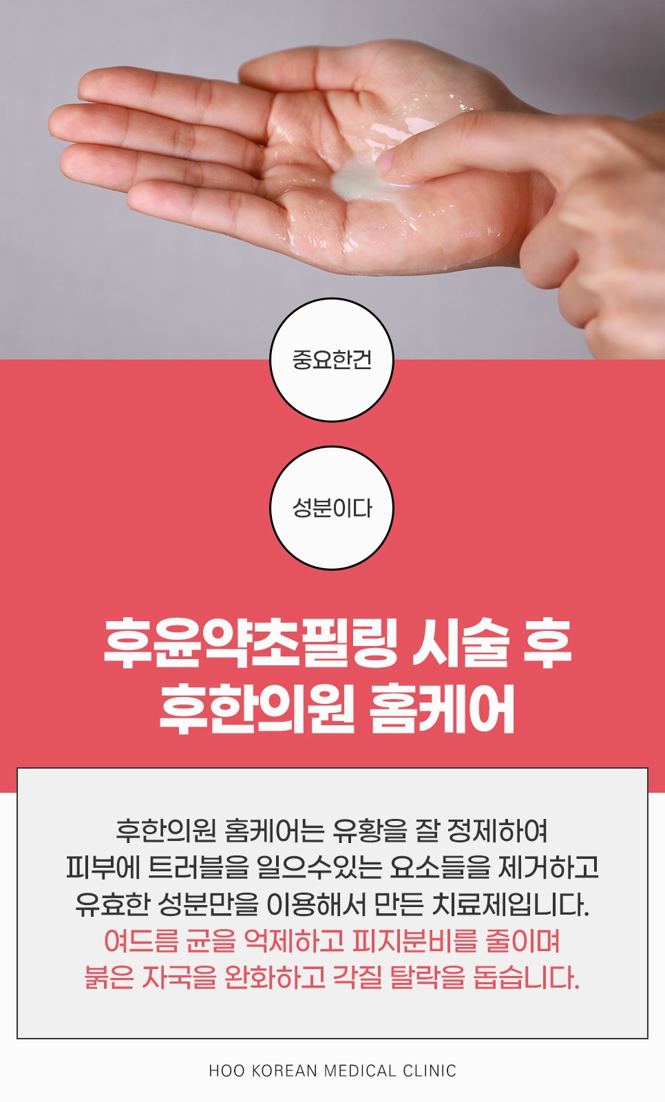 유황을 정제한 성분으로 여드름균 억제와 붉은 자극 완화를 돕는 후윤약초필링 시술 후 후한의원 홈케어