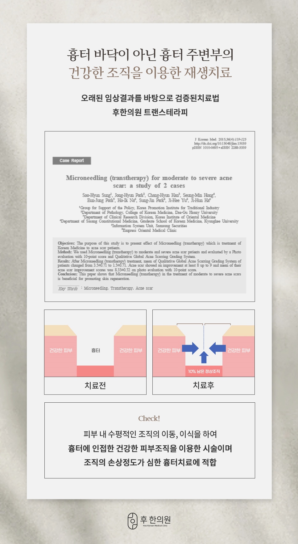 평촌여드름흉터 트랜스테라피 재생치료 원리