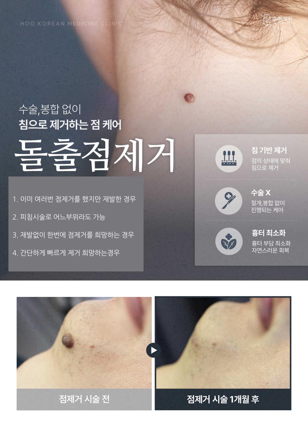 랜딩이미지